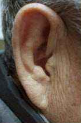 耳朵是身體的“長壽開關”每天揉一揉趕走小毛病