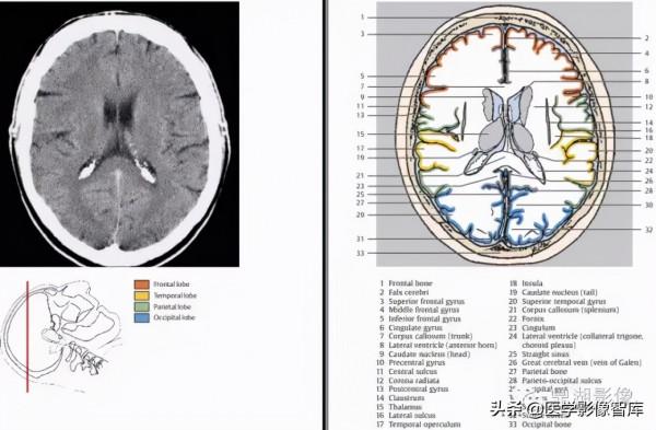 CT斷層解剖圖譜最全總結「推薦收藏」 CT斷層解剖圖譜最全總結「推薦收藏」