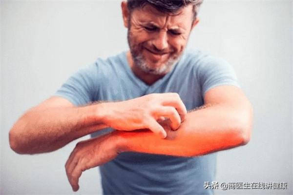 血糖失控面板瞞不住？醫生告訴你，面板若有3種表現你該控糖了