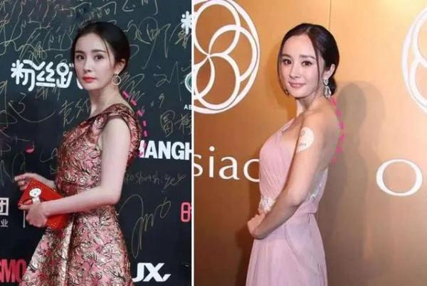 明星駝背有多醜，高顏值都拯救不了，楊冪劉亦菲均上榜