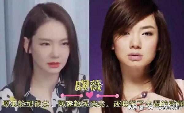 “整容後”一飛沖天的明星,華晨宇屌絲變男神,鞠婧禕越變越好看 “整容後”一飛沖天的明星,華晨宇屌絲變男神,鞠婧禕越變越好看