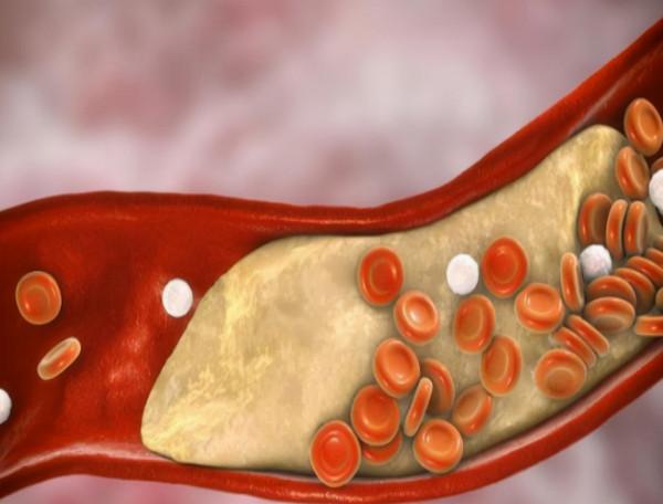 膽固醇、甘油三酯、脂蛋白超標？血脂與日常飲食關係多大？如何調