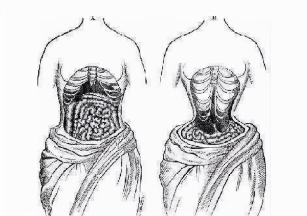 吞寄生蟲，用腐蝕液體洗臉，吃砒霜，英國女性超重口的變美套路