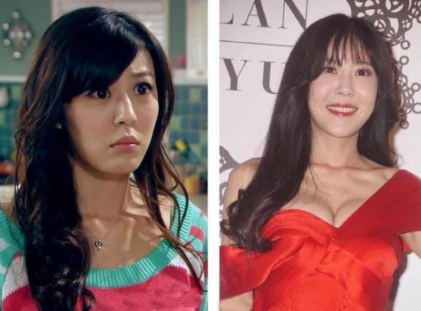 整容整毀的女星 整容整毀的女星