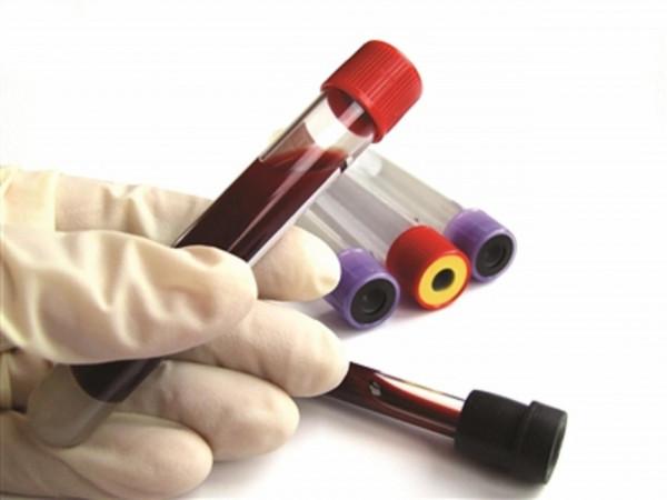 血脂高了,血液會變稠?還會堵血管?醫生:這樣的說法你也信? 血脂高了,血液會變稠?還會堵血管?醫生:這樣的說法你也信?