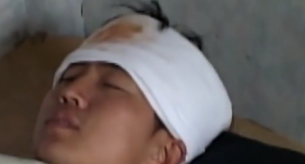 故事:韓國60歲大叔出車禍,檢查發現脖內有子彈,為何40年毫無察覺