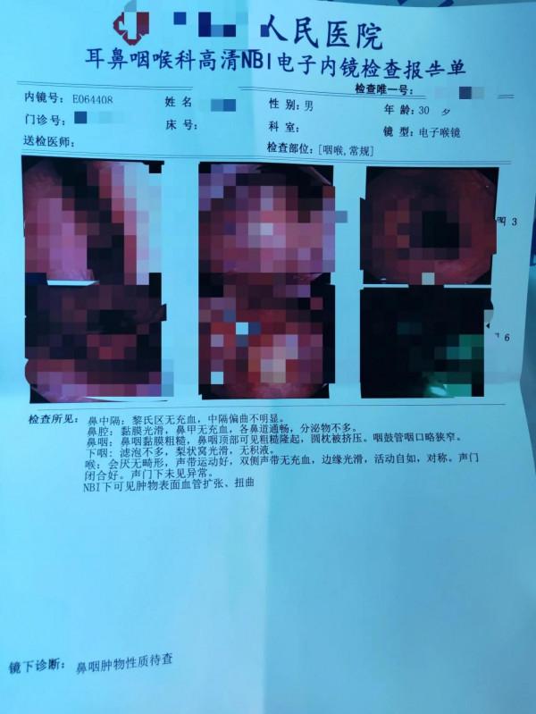 很多人問我癌症有什麼反應或症狀