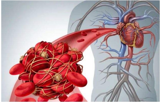 長期口服阿司匹林腸溶片和阿託伐他汀鈣會怎樣？有何注意事項？