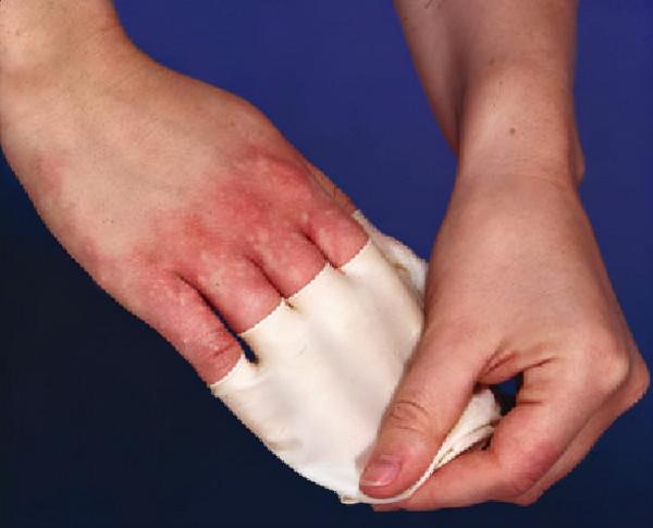 明明是防護用具,有的人卻越用越受傷 明明是防護用具,有的人卻越用越受傷