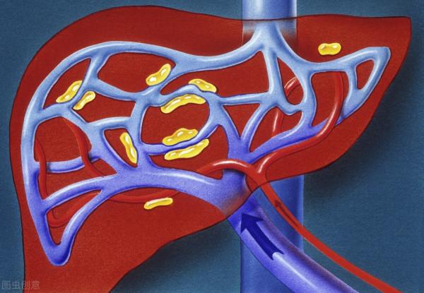 為什麼肝癌早期診斷要查甲胎蛋白?升高意味著肝癌嗎?真不一定 為什麼肝癌早期診斷要查甲胎蛋白?升高意味著肝癌嗎?真不一定