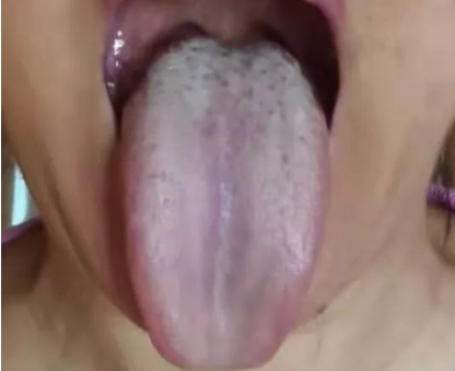 身體疲倦乏力,有淤血?一個名方五味藥,補氣化瘀、橫掃氣虛血瘀 身體疲倦乏力,有淤血?一個名方五味藥,補氣化瘀、橫掃氣虛血瘀