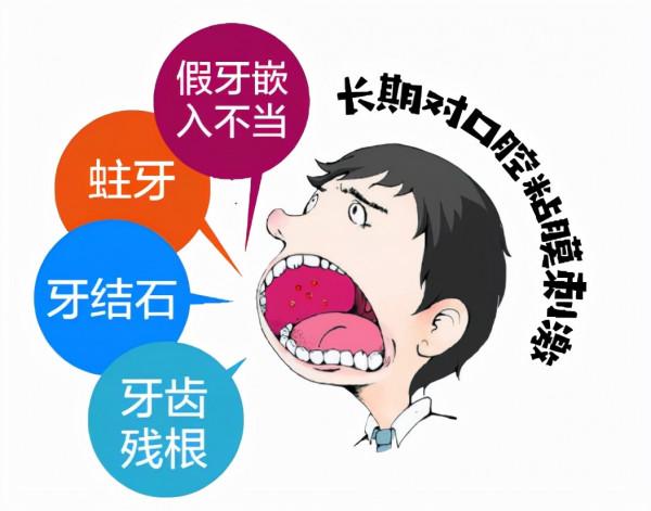 關於口腔癌，你瞭解多少？