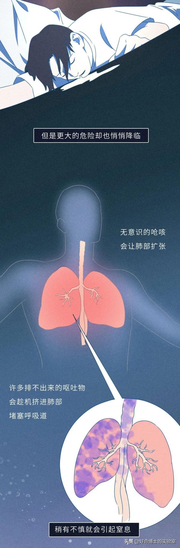 吞安眠藥自殺,到底有多痛苦? 吞安眠藥自殺,到底有多痛苦?