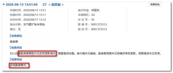 鼻子問題帶出肺病,17歲小夥咳嗽8年,氣管鏡吸出“一斤痰” 鼻子問題帶出肺病,17歲小夥咳嗽8年,氣管鏡吸出“一斤痰”