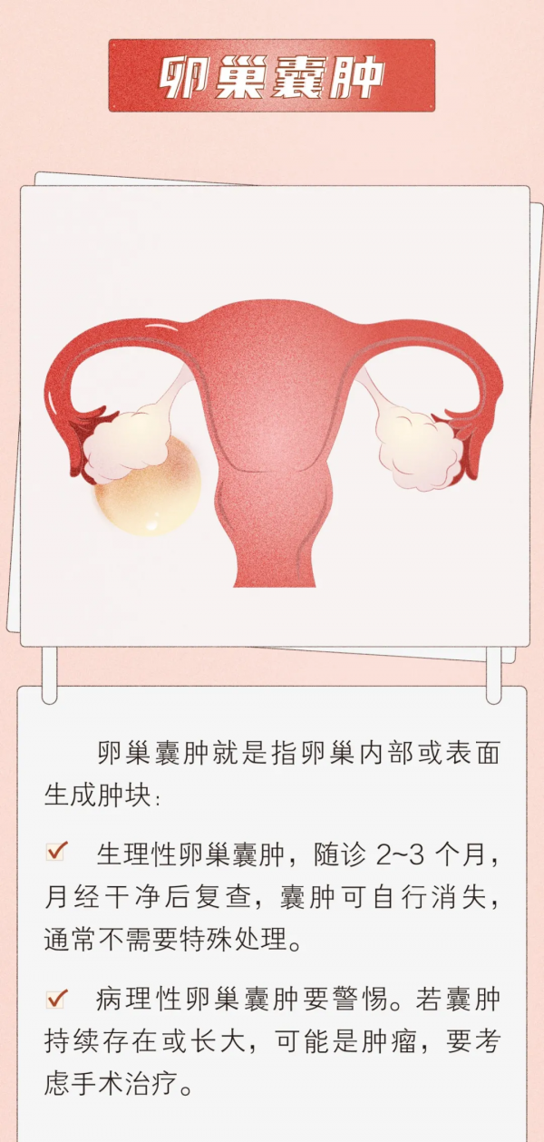 囊腫和腫瘤，「腫」的一樣嗎？