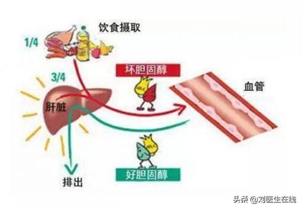 低密度脂蛋白，為什麼會高？醫生總結：4點主要原因