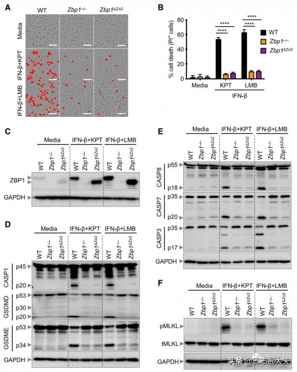 細胞死亡領域缺失的一塊拼圖:PANoptosis 細胞死亡領域缺失的一塊拼圖:PANoptosis