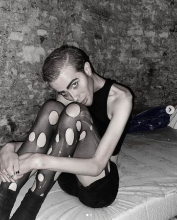 網紅減肥瘦到「骨頭清楚現形」四肢細如竹竿！對比照曝…網全嚇壞