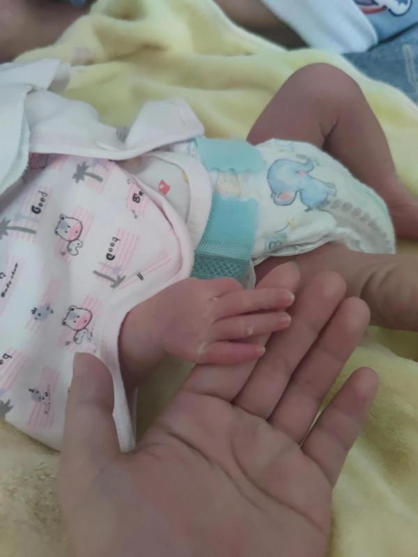 吐了整個孕期的閨蜜，小孩36+4出生了