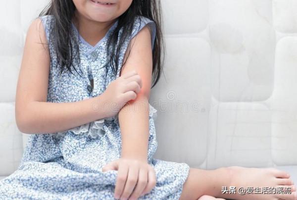 合理應用外用藥物治療兒童銀屑病 合理應用外用藥物治療兒童銀屑病