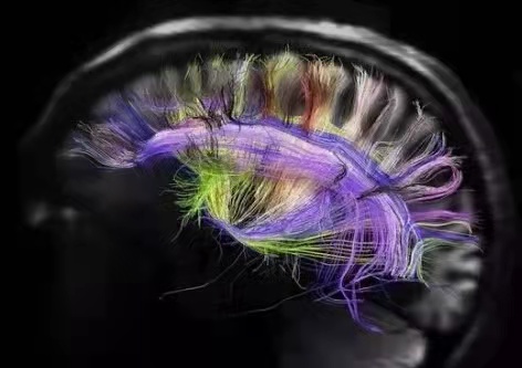 聰明孩子的大腦長啥樣子？