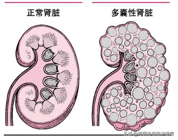 天天吃沙坦類降壓藥,忽略這3點,等於白吃藥,還可能有風險 天天吃沙坦類降壓藥,忽略這3點,等於白吃藥,還可能有風險
