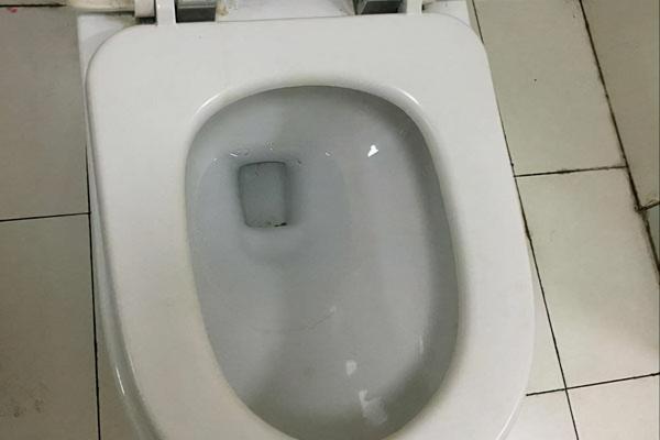 身體若發出這5個訊號，或要去做“直腸指檢”，別害羞