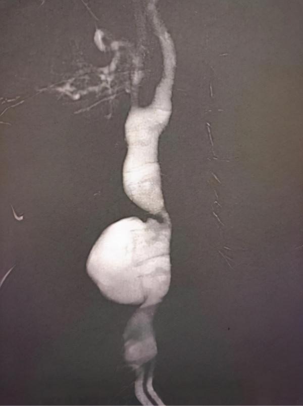 年輕小夥“甩頭”過猛，脖子鼓起一個“包”，血管差點破裂