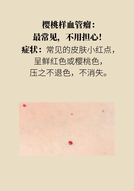 身上出現紅斑、紅點別不當回事，警惕癌變
