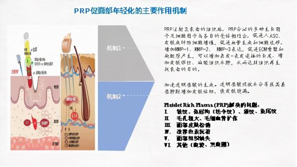 愛美女士的新選擇——富血小板血漿（PRP）
