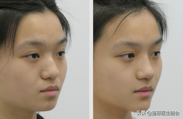 整得再美，也是“一眼假”！想要悄悄變美，怎麼就那麼難？