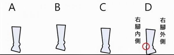 如何糾正不良體態