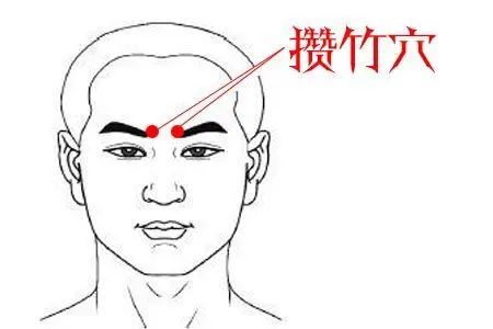 國醫大師石學敏：經筋刺法及應用