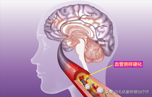 什麼食用油不健康？是大豆油嗎？提醒：這類油要儘量少吃