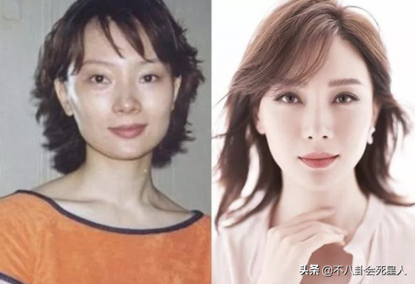 中年女星整容後遺症一堆！臉像鞋拔子，不敢做大表情，演戲沒法看