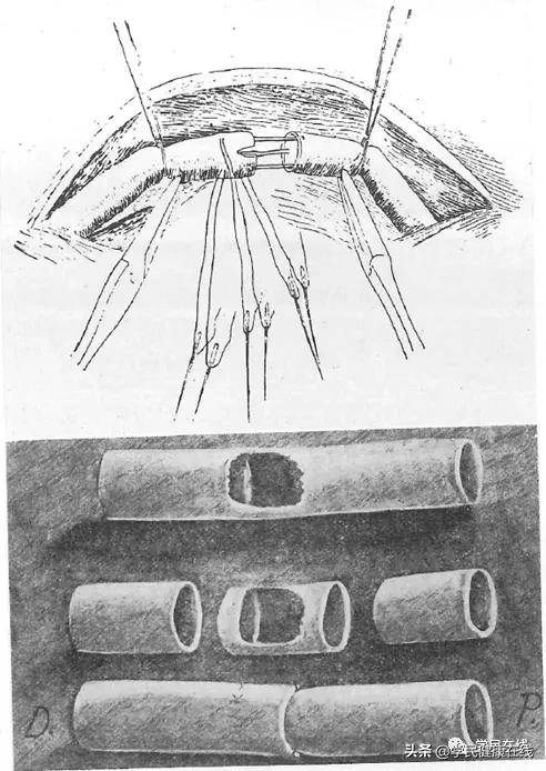 血管外科的起點