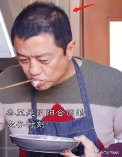 “禿頂”危機的10大男神，有人29歲髮際線堪憂，有人常年戴假髮套