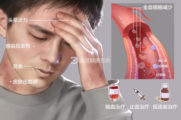 安徽一女子以為自己是婦科疾病,卻被確診為重型血液病 安徽一女子以為自己是婦科疾病,卻被確診為重型血液病