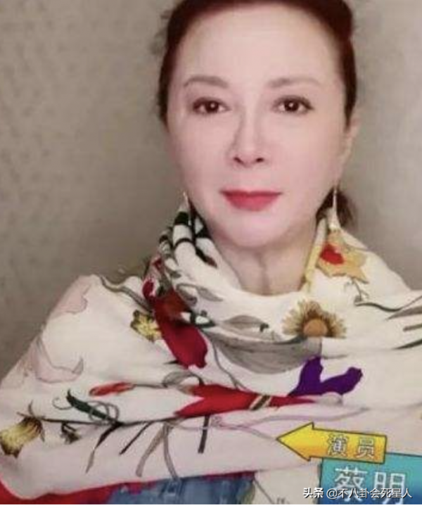 中年女星整容後遺症一堆！臉像鞋拔子，不敢做大表情，演戲沒法看