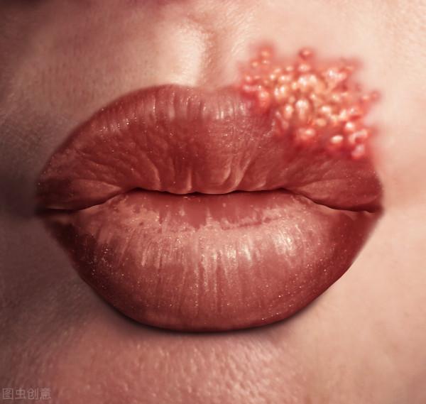 大全！秋天最容易得的3種皮膚疾病及預防方法