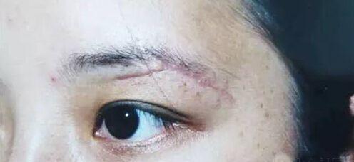 為什麼不建議女人紋眉?原因有這3點,看完你可能也不想紋了 為什麼不建議女人紋眉?原因有這3點,看完你可能也不想紋了