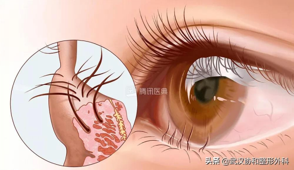 睫不在長，外向就好