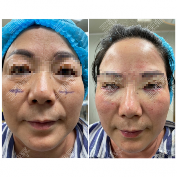 一個切口改善八個問題？快來看是什麼