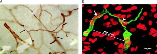 全球首個新冠口服藥物獲批!新冠病毒卻正在“吃掉”人類的大腦 全球首個新冠口服藥物獲批!新冠病毒卻正在“吃掉”人類的大腦