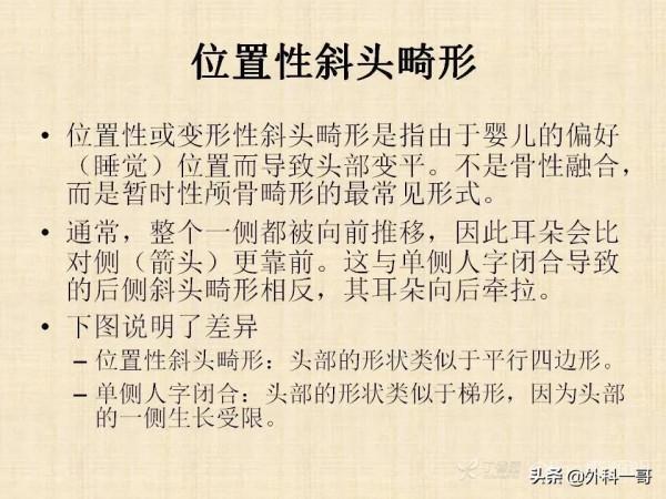 小兒顱縫早閉的診斷治療