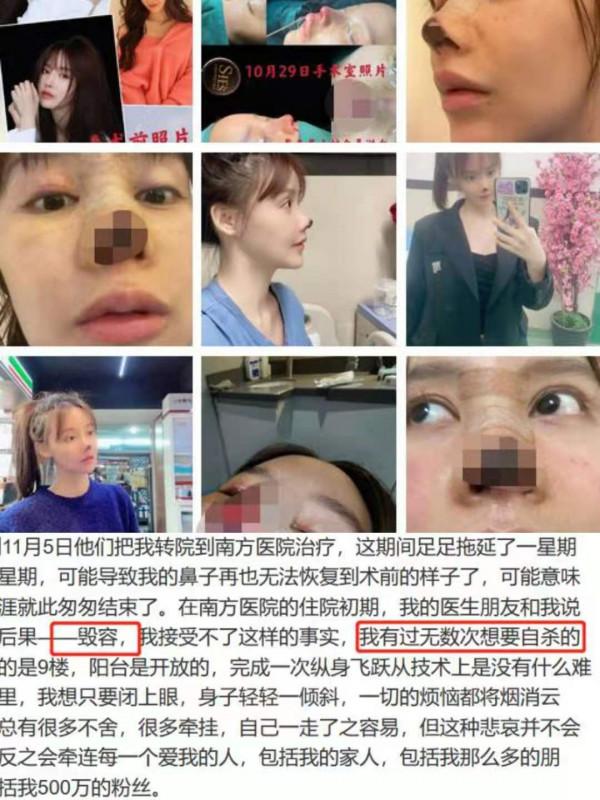 明星“假鼻子”大PK，誰的一捏就扁，誰的是“人間阿凡達”？