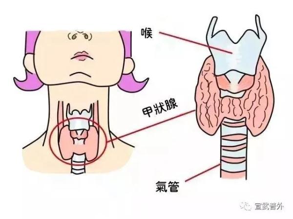 甲狀腺癌的“自白”