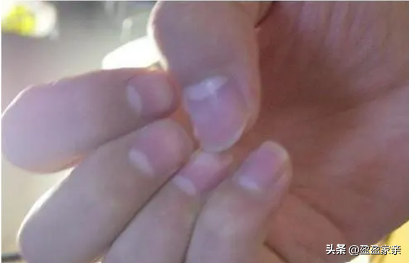 有的人手指甲上有月牙,有的人卻沒有,這是為什麼呢? 有的人手指甲上有月牙,有的人卻沒有,這是為什麼呢?