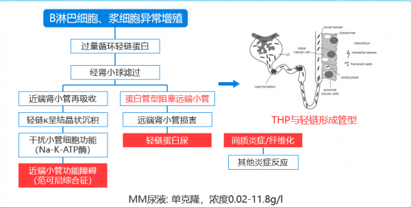 多發性骨髓瘤合併腎功能損傷該如何選擇治療? 多發性骨髓瘤合併腎功能損傷該如何選擇治療?