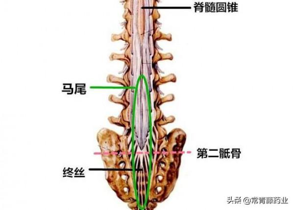 34歲男子因腰椎間盤突出而癱瘓,如此恐怖?一定要重視這種情況 34歲男子因腰椎間盤突出而癱瘓,如此恐怖?一定要重視這種情況